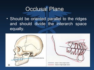 Occlusal Plane
• Should be oriented parallel to the ridges
and should divide the interarch space
equally.
 