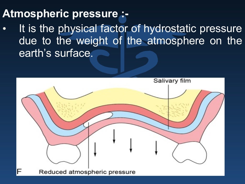 Retention stability support in complete dentures
