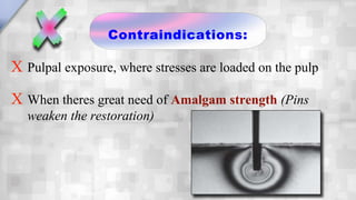Indications and Contraindications of Retentive pins | PPSX