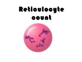 ReticulocyteReticulocyte
countcount
 