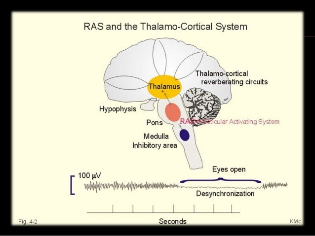 Reticular formation