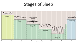 Stages of Sleep
 