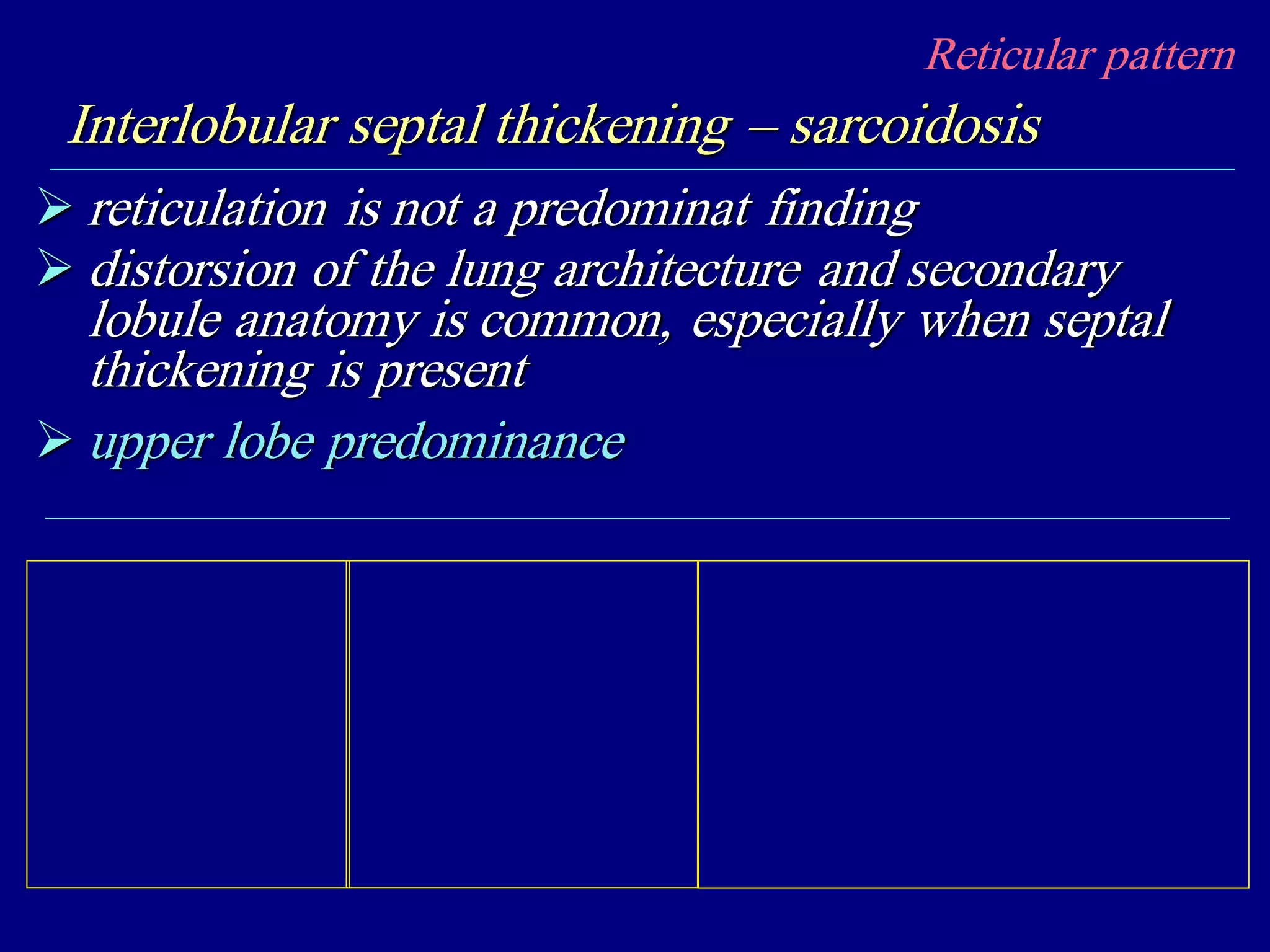 Reticular pattern
Interlobular septal thickening – sarcoidosis
 reticulation is not a predominat finding
 distorsion of the lung architecture and secondary
lobule anatomy is common, especially when septal
thickening is present
 upper lobe predominance
 