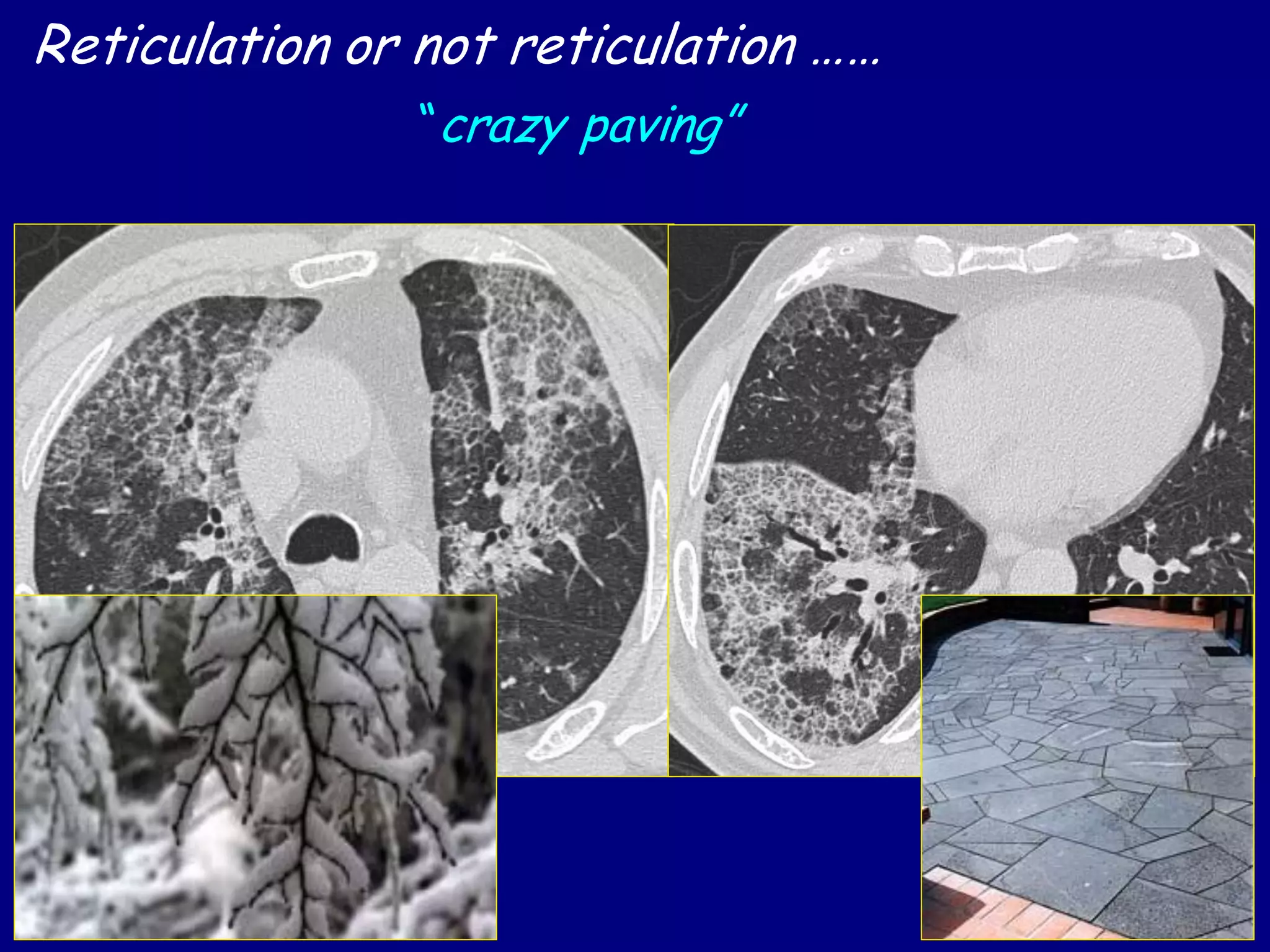 Reticulation or not reticulation ……
“crazy paving”
 