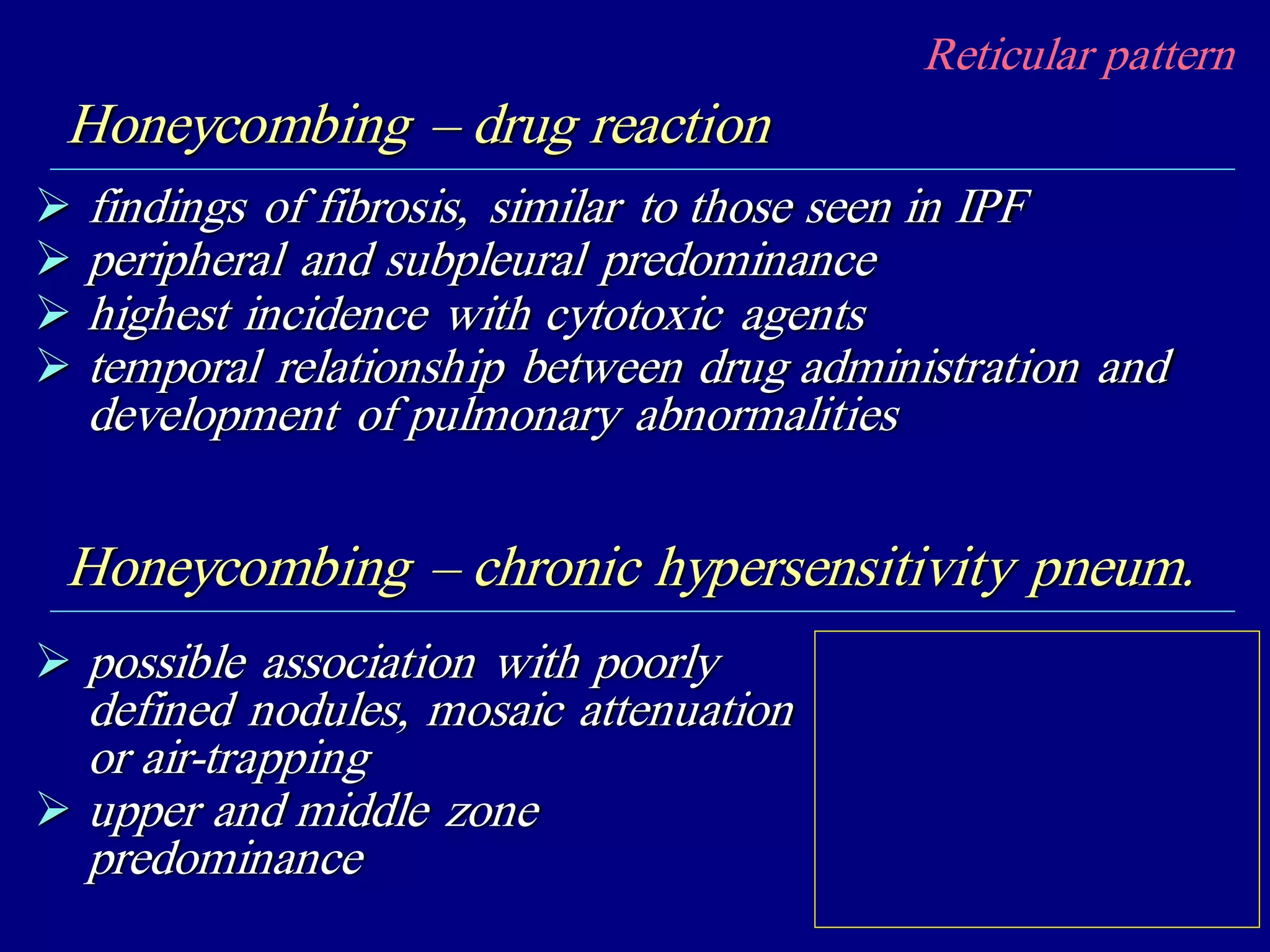 Reticular pattern
Honeycombing – drug reaction
 findings of fibrosis, similar to those seen in IPF
 peripheral and subpleural predominance
 highest incidence with cytotoxic agents
 temporal relationship between drug administration and
development of pulmonary abnormalities
Honeycombing – chronic hypersensitivity pneum.
 possible association with poorly
defined nodules, mosaic attenuation
or air-trapping
 upper and middle zone
predominance
 