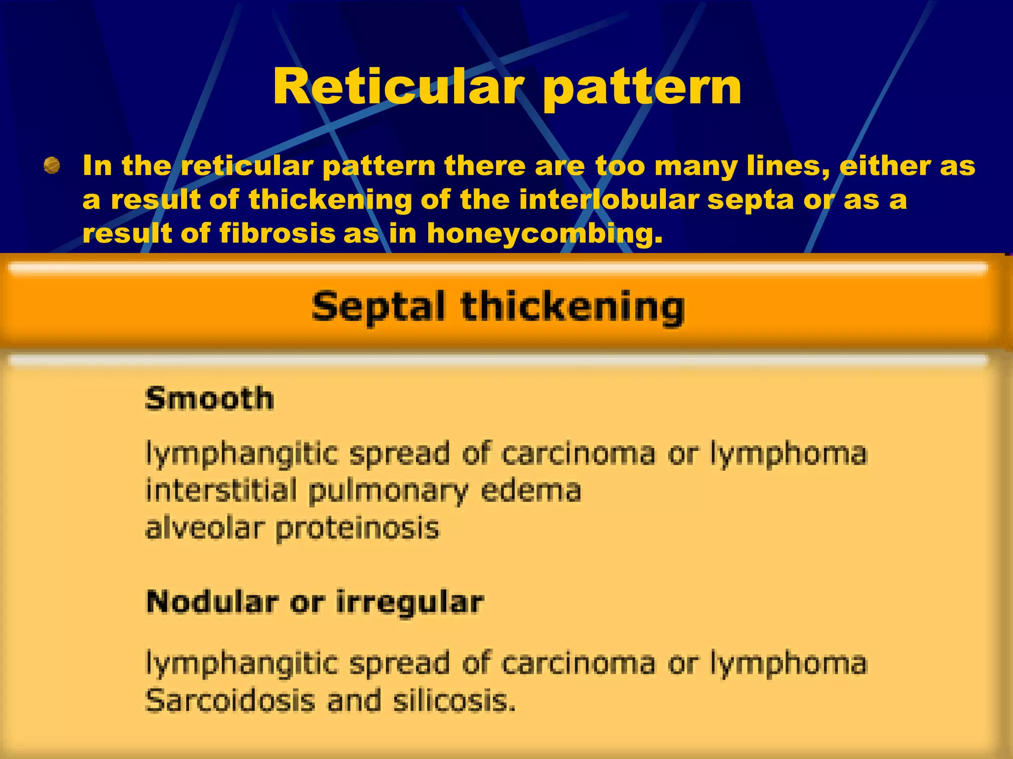 Reticular pattern
In the reticular pattern there are too many lines, either as
a result of thickening of the interlobular septa or as a
result of fibrosis as in honeycombing.
 