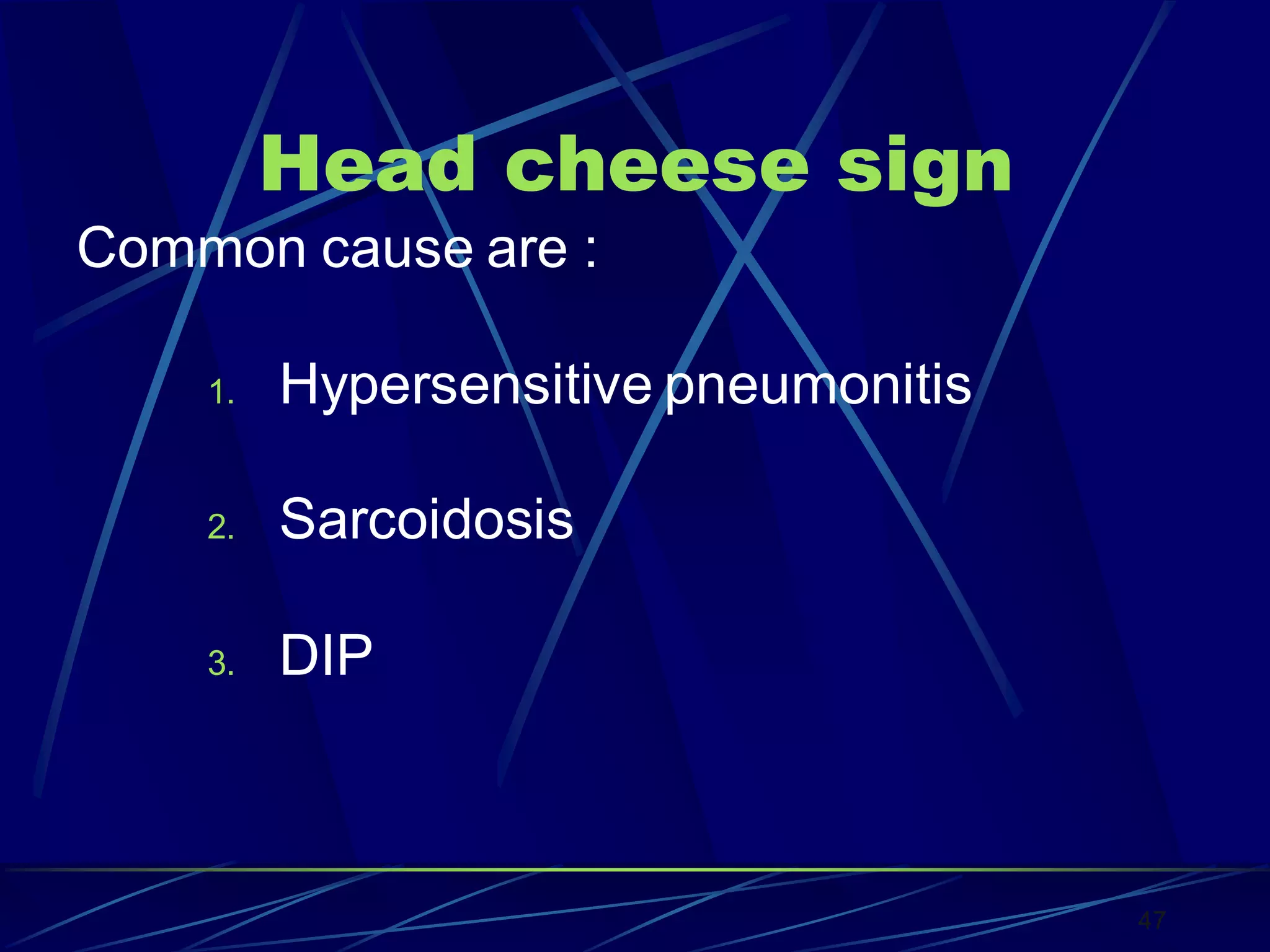 Head cheese sign
Common cause are :
1. Hypersensitive pneumonitis
2. Sarcoidosis
3. DIP
47
 