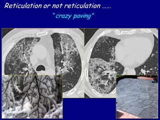 Reticulation or not reticulation ……
“crazy paving”
 