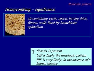 Reticular pattern
Honeycombing – significance
air-containing cystic spaces having thick,
fibrous walls lined by bronchiolar
epithelium

fibrosis is present
UIP is likely the histologic pattern
IPF is very likely, in the absence of a
known disease
 