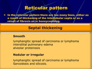 Reticular pattern
In the reticular pattern there are too many lines, either as
a result of thickening of the interlobular septa or as a
result of fibrosis as in honeycombing.
 