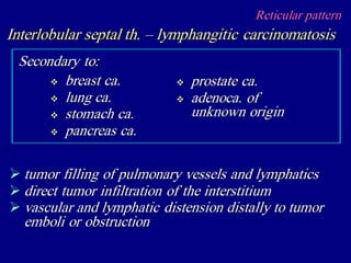 Reticular pattern
Interlobular septal th. – lymphangitic carcinomatosis
 tumor filling of pulmonary vessels and lymphatics
 direct tumor infiltration of the interstitium
 vascular and lymphatic distension distally to tumor
emboli or obstruction
 breast ca.
 lung ca.
 stomach ca.
 pancreas ca.
Secondary to:
 prostate ca.
 adenoca. of
unknown origin
 