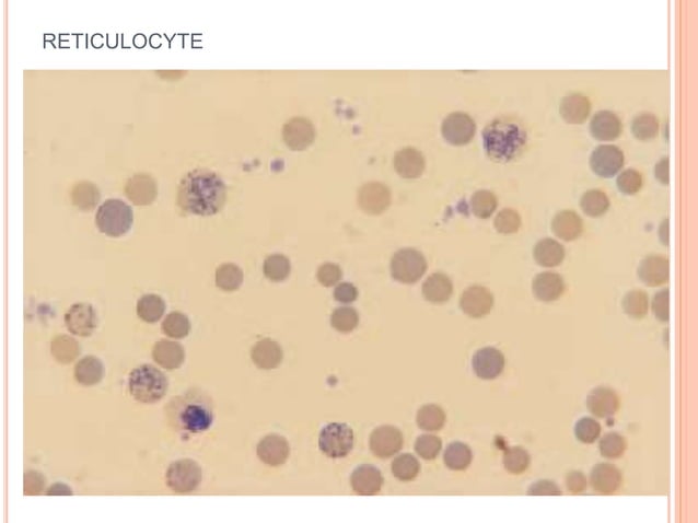 Reticulocyte Count PPT