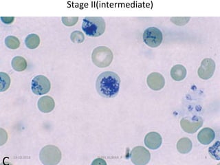 Stage II(intermediate)
13-10-2018 8SUNIL KUMAR. P
 