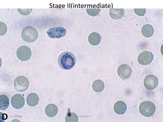 Stage II(intermediate)
D 13-10-2018 9SUNIL KUMAR. P
 