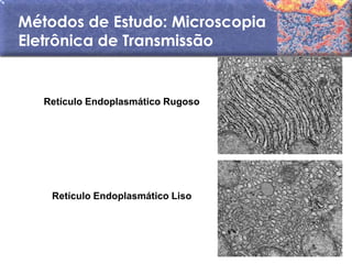 Métodos de Estudo: Microscopia
Eletrônica de Transmissão


   Retículo Endoplasmático Rugoso




    Retículo Endoplasmático Liso
 