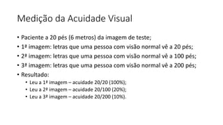 Medição da Acuidade Visual
• Paciente a 20 pés (6 metros) da imagem de teste;
• 1ª imagem: letras que uma pessoa com visão normal vê a 20 pés;
• 2ª imagem: letras que uma pessoa com visão normal vê a 100 pés;
• 3ª imagem: letras que uma pessoa com visão normal vê a 200 pés;
• Resultado:
• Leu a 1ª imagem – acuidade 20/20 (100%);
• Leu a 2ª imagem – acuidade 20/100 (20%);
• Leu a 3ª imagem – acuidade 20/200 (10%).
 
