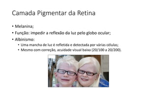 Camada Pigmentar da Retina
• Melanina;
• Função: impedir a reflexão da luz pelo globo ocular;
• Albinismo:
• Uma mancha de luz é refletida e detectada por várias células;
• Mesmo com correção, acuidade visual baixa (20/100 a 20/200).
 