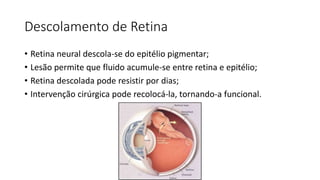 Descolamento de Retina
• Retina neural descola-se do epitélio pigmentar;
• Lesão permite que fluido acumule-se entre retina e epitélio;
• Retina descolada pode resistir por dias;
• Intervenção cirúrgica pode recolocá-la, tornando-a funcional.
 