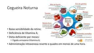 Cegueira Noturna
• Baixa sensibilidade da retina;
• Deficiência de Vitamina A;
• Dieta deficiente por meses:
• Fígado armazena Vitamina A;
• Administração intravenosa reverte o quadro em menos de uma hora.
 