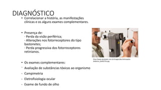 DIAGNÓSTICO• Correlacionar a história, as manifestações
clínicas e os alguns exames complementares.
• Presença de:
· Perda da visão periférica;
· Alterações nos fotorreceptores do tipo
bastonetes;
· Perda progressiva dos fotorreceptores
retinianos.
• Os exames complementares:
⁻ Avaliação de substâncias tóxicas ao organismo
- Campimetria
- Eletrofisiologia ocular
- Exame de fundo de olho
http://www.abcdoabc.com.br/images/abc/retinopatia-
diabetica_8a40272a.jpg
 