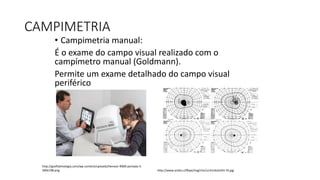 CAMPIMETRIA
• Campimetria manual:
É o exame do campo visual realizado com o
campímetro manual (Goldmann).
Permite um exame detalhado do campo visual
periférico
http://www.scielo.cl/fbpe/img/rmc/v141n6/art01-f4.jpg
http://gvoftalmologia.com/wp-content/uploads/Henson-9000-portada-3-
300x198.png
 