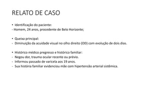 RELATO DE CASO
• Identificação do paciente:
- Homem, 24 anos, procedente de Belo Horizonte;
• Queixa principal:
- Diminuição da acuidade visual no olho direito (OD) com evolução de dois dias.
• Histórico médico pregresso e histórico familiar:
- Negou dor, trauma ocular recente ou prévio.
- Informou passado de varicela aos 19 anos.
- Sua história familiar evidenciou mãe com hipertensão arterial sistêmica.
 