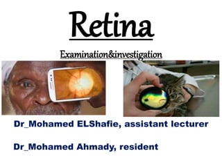 Retina
Examination&investigation
Dr_Mohamed ELShafie, assistant lecturer
Dr_Mohamed Ahmady, resident
 