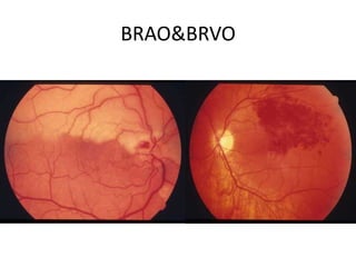 Retinal Examination& Invistegation | PPTX