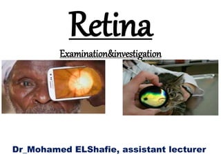 Retina
Examination&investigation
Dr_Mohamed ELShafie, assistant lecturer
 