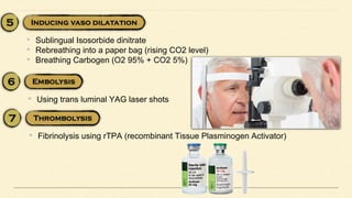 • Sublingual Isosorbide dinitrate
• Rebreathing into a paper bag (rising CO2 level)
• Breathing Carbogen (O2 95% + CO2 5%)
• Using trans luminal YAG laser shots
• Fibrinolysis using rTPA (recombinant Tissue Plasminogen Activator)
 