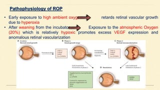 • Early exposure to high ambient oxygen retards retinal vascular growth
due to hyperoxia
• After weaning from the incubator Exposure to the atmospheric Oxygen
(20%) which is relatively hypoxic promotes excess VEGF expression and
anomalous retinal vascularization
 