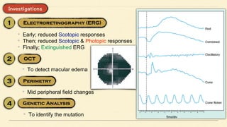 • Early; reduced Scotopic responses
• Then; reduced Scotopic & Photopic responses
• Finally; Extinguished ERG
• To detect macular edema
• Mid peripheral field changes
• To identify the mutation
 