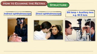 Indirect ophthalmoscope Direct ophthalmoscope
Slit lamp + Auxiliary lens
e.g. 90 D lens
 