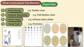 1 • e.g. Snellen chart
2 • e.g. Pelli Robson chart
3 • e.g. Ishihara colour plates
4 • e.g. Perimetry
 