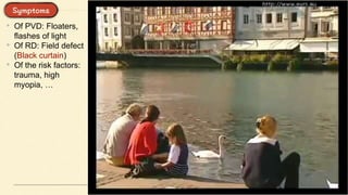 • Of PVD: Floaters,
flashes of light
• Of RD: Field defect
(Black curtain)
• Of the risk factors:
trauma, high
myopia, …
 