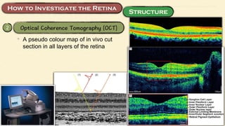 2
• A pseudo colour map of in vivo cut
section in all layers of the retina
 