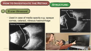 3
• Used in case of media opacity e.g. opaque
cornea, cataract, vitreous haemorrhage
 