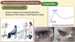 • Used to measure the massed electrical
response of the retina to brief flashes of light
 
