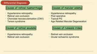 • Hypertensive retinopathy
• Retinal vein occlusion
• Choroidal neovascularisation (CNV)
• Terson syndrome
• Hypertensive retinopathy
• Retinal vein occlusion
• Hypertensive retinopathy
• Post operative
• Topical PG
• Age Related Macular Degeneration
• Retinal vein occlusion
• Ocular ischaemic syndrome
 