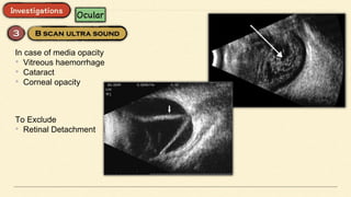 In case of media opacity
• Vitreous haemorrhage
• Cataract
• Corneal opacity
To Exclude
• Retinal Detachment
 