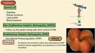 • Diabetes
• Kidney functions
• Lipid profile
• Blood pressure
• Follow up the patient along with strict control of DM
• Pan Retinal Photocoagulation (PRP)
To destroy the ischemic retina thus decreasing VEGF
Improve retinal oxygenation by exposing it to choroidal
circulation
 