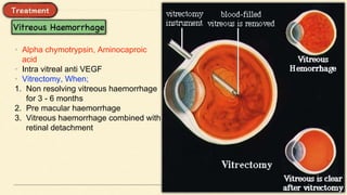 • Alpha chymotrypsin, Aminocaproic
acid
• Intra vitreal anti VEGF
• Vitrectomy, When;
1. Non resolving vitreous haemorrhage
for 3 - 6 months
2. Pre macular haemorrhage
3. Vitreous haemorrhage combined with
retinal detachment
 