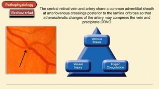 The central retinal vein and artery share a common adventitial sheath
at arteriovenous crossings posterior to the lamina cribrosa so that
atherosclerotic changes of the artery may compress the vein and
precipitate CRVO
 