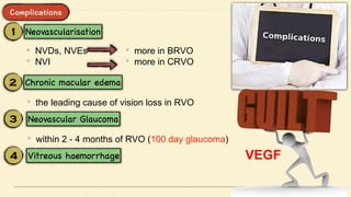 • NVDs, NVEs
• NVI
• more in BRVO
• more in CRVO
• the leading cause of vision loss in RVO
• within 2 - 4 months of RVO (100 day glaucoma)
VEGF
 