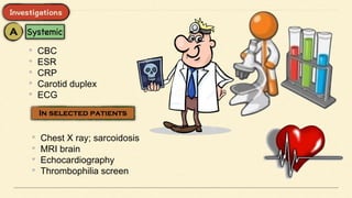• CBC
• ESR
• CRP
• Carotid duplex
• ECG
• Chest X ray; sarcoidosis
• MRI brain
• Echocardiography
• Thrombophilia screen
 
