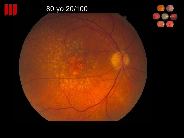 80 Yo 20 100 80 Yo 20 100