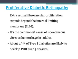Proliferative Diabetic Retinopathy
Extra retinal fibrovascular proliferation
extends beyond the internal limiting
membrane (ILM).
• It’s the commonest cause of spontaneous
vitreous hemorrhage in adults.
• About 2/3rd of Type I diabetics are likely to
develop PDR over 3 decades.
 