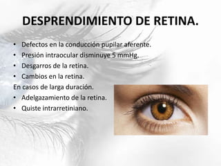 DESPRENDIMIENTO DE RETINA.
• Defectos en la conducción pupilar aferente.
• Presión intraocular disminuye 5 mmHg.
• Desgarros de la retina.
• Cambios en la retina.
En casos de larga duración.
• Adelgazamiento de la retina.
• Quiste intrarretiniano.
 