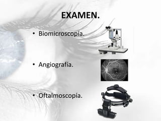 EXAMEN.
• Biomicroscopía.
• Angiografía.
• Oftalmoscopía.
 