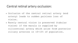 Retina 2.pptx